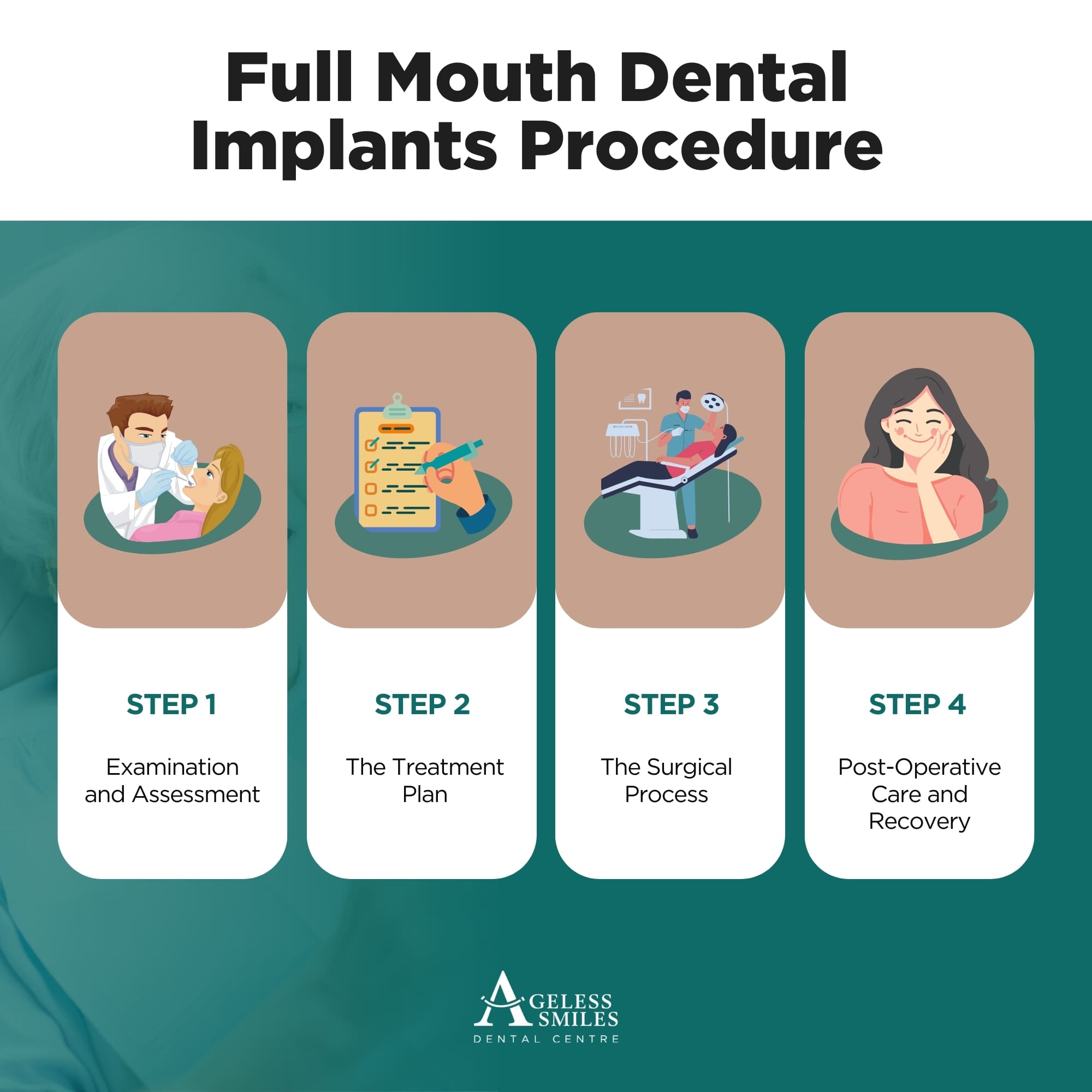 Full Mouth Dental Implants Cost and Options In Perth